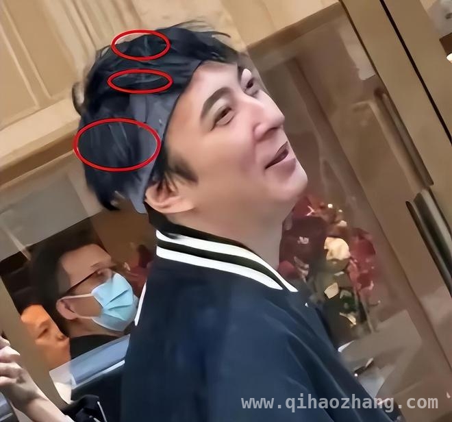 从风流公子到憔悴青年，王思聪经历了什么？
