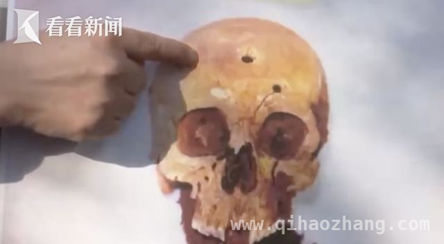 民间呼吁：揭开东京人骨背后731部队的罪恶真相